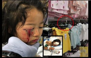 sajagempak.com - Kelopak Mata Anak 6 Tahun Terkoyak Akibat Terkena Besi Penggantung Rak Pakaian Di Shopping Mall