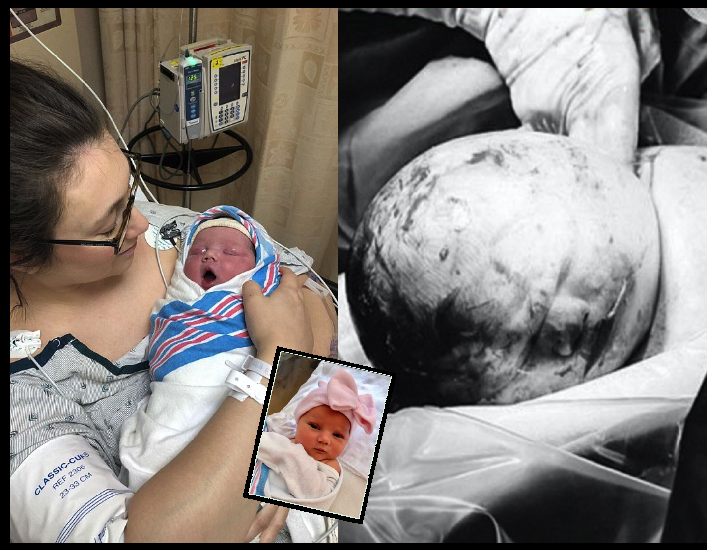 sajagempak.com - Panik Bayi Lahir Dengan Benda Aneh Di Kepala, Bapa Makin Bingung Bila Nurse Suruh Ambil Gambar