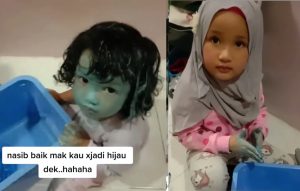 Ibu Terperanjat Melihat Muka Adik Bertukar Biru, Kedua Anaknya Siap Buat Muka Tak Bersalah - sajagempak.com
